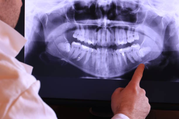 Best Same-Day Emergency Dental Services in Demarest, NJ