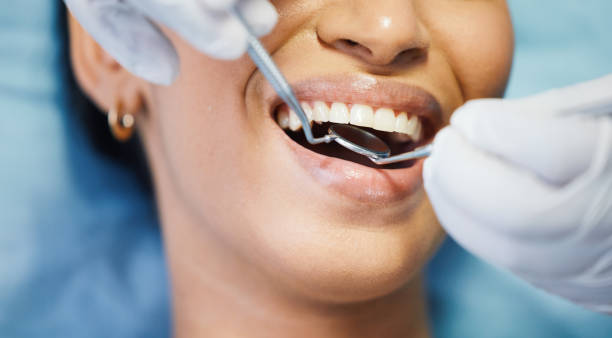 Best Emergency Dental Care for Broken or Chipped Teeth in Demarest, NJ