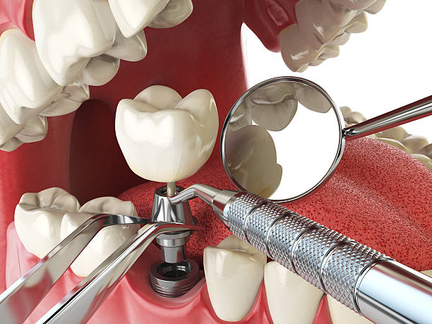 Best Cosmetic Emergency Dentistry in Demarest, NJ